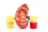 Photo for Global Kidney Function Test Market Analysis of Top Players, Share, Growth, Region Wise, Application and Forecasts by 2025