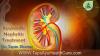 Photo for Ayurvedic Treatment of Nephritis - Buy Online Medicine