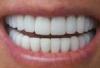 Photo for Cosmetic dentistry