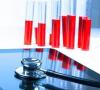 Photo for In-situ Hybridization Market – Industry Insights Size, Growth Trend and Analysis, 2018 – 2026