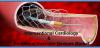 Photo for Rising Incidence of Coronary Diseases to Drive the Growth of the Interventional Cardiology Devices Market