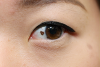 Photo for Eye Melanoma Market Innovative Treatments, Key Methodologies, Top Players Success Milestones and Forecasts to 2023