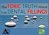 Photo for Amalgam safe removal. Safe removal of mercury fillings.