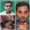 Photo for Laser Treatment for Oral/Mouth & Tongue Cancer in Mumbai | Specialist Doctor