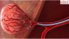Photo for Embolization Particle Market Outlook, Growth Prospects and Key Opportunities 2024