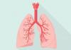 Photo for The Global Bronchitis Market is expected to grow at a CAGR of 5.3% during the forecast period.
