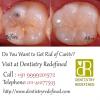 Photo for Best Implant Dentist in Delhi | Dial +91 9999201572