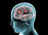 Photo for Brain Base Knife Package Market Segments, Key Players, Drivers, Trends and Forecast to 2025