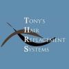 Photo for Tony's Hair Replacement Systems
