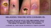 Photo for Cancer Cures made Illegal