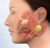 Photo for Parotid Tumors Market Analysis of Top Players, Share, Growth, Region Wise, Application and Forecasts by 2025