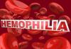 Photo for Hemophilia Treatment Market Shares Analysis, Key Development Strategies and Forecasts Till 2023