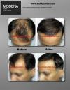 Photo for Modena Hair Transplant Clinic