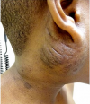 Photo for Neurocutaneous Disorder Market Forecasts by Industry Drivers, Regions Till 2023