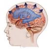 Photo for Pseudotumor Cerebri Market Key Development Areas, Financial Overview, Top Players and Forecasts Till 2023