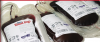 Photo for Disposable Blood Bags Market Trends, and Forecast to 2026
