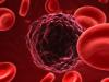 Photo for Sickle Cell Anemia Therapeutics Market Growth - Global Industry Insights, Development Trends and Forecast 2017 - 2025