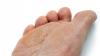 Photo for Best Diabetic Foot Clinic Ontario