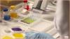 Photo for Immunoassays Industry: Potential Growth Analysis and Innovations (2019-2024)