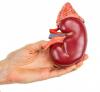 Photo for Global Chronic Kidney Market 2023 New Technology Development and Revenue of Top Players