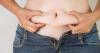 Photo for Say Bye to Obesity with Right Procedures