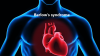 Photo for Barlow Syndrome Market 2018-2023 Top players, Age, Treatment and Regional Forecast