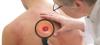 Photo for Merkel Cell Carcinoma Market to grow at a CAGR of 7.40% Between 2018-2023, Top players and Country wise Segmented Industry Report