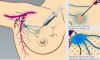 Photo for The global sentinel node biopsy market is expected to grow at a CAGR of 5.1% during the forecast period.