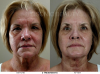 Photo for Wheaton Facial Spa