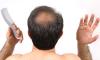 Photo for Best Hair Transplant Dubai
