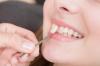 Photo for Get a Bright Smile by Teeth Whitening San Antonio service