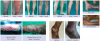 Photo for Laser Treatment for Varicose Veins in Dubai - Orchid Laser Center
