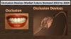 Photo for Occlusion Devices Market Growth Rate, Developing Trends, Manufacturers, Countries and Application, Global Forecast To 2024