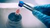 Photo for Biobanking Market Innovative Treatments, Key Methodologies, Top Players Success Milestones and Forecasts to 2023
