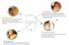 Photo for FUE Hair Transplant in Dubai