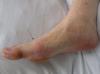 Photo for Hire Professional Foot Care Ontario Service Provider