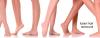 Photo for Top 5 Amazing Reasons to Undergo Laser Hair Removal Treatment | NewAgeLaser