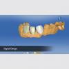 Photo for Dental Crowns Lab Newark