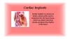 Photo for Cardiac Implants Market Potential Growth, Analysis, Strategies and Forecast 2024