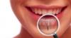 Photo for Teeth whitening
