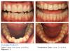 Photo for Westlake Smile Design Invisalign Dentists