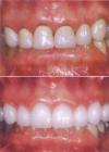 Photo for Cosmetic Dentistry: Simple Ways To Enhance Your Personality