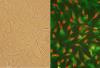 Photo for human cardiac stromal cells