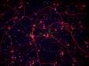 Photo for diseased primary cells