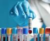 Photo for Cancer Diagnostics & Technology Market Potential Growth, Analysis, Strategies and Forecast 2024