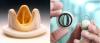 Photo for Global Prosthetic Heart Valve Market is Growing at a Significant Rate in the Forecast Period 2018-2025