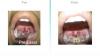 Photo for Tonsils