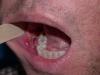 Photo for Oral Cancer & Laser Treatment- Orchid Oncology Centre