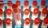 Photo for Stem Cell Banking Market 2023 - Trends, Business Strategies and Opportunities with Key Players Analysis