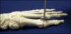 Photo for 2018 World Bone Staple Market CAGR Value, Outlook, Analysis and Future Forecast